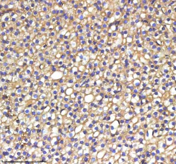 Zebrafish Srebf1 Antibody Liver Tissue IHC. Immunohistochemistry staining of zebrafish Srebf1 protein using Zebrafish Srebf1 antibody, HRP-labeled secondary and DAB substrate. Srebf1 was detected in a paraffin-embedded section of zebrafish liver tissue. HIER: boil tissue sections in pH8 EDTA for 20 min and allow to cool before testing.