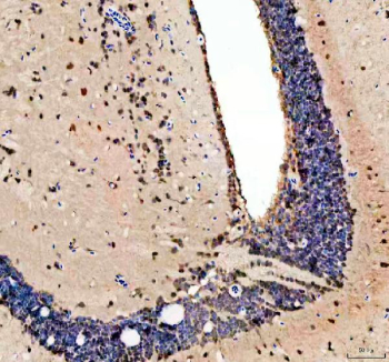 Zebrafish Psmc3 Antibody Brain Tissue IHC. Immunohistochemistry staining of FFPE zebrafish brain tissue with Psmc3 antibody, HRP-labeled secondary and DAB substrate. HIER: boil tissue sections in pH8 EDTA for 20 min and allow to cool before testing.