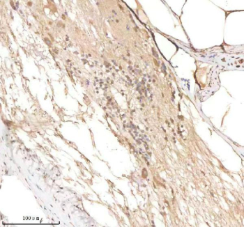 Zebrafish Psmc3 Antibody Spinal Tissue IHC. Immunohistochemistry staining of FFPE zebrafish spinal tissue with Psmc3 antibody, HRP-labeled secondary and DAB substrate. HIER: boil tissue sections in pH8 EDTA for 20 min and allow to cool before testing.