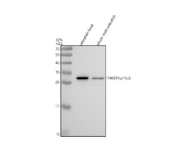 Zebrafish Twist Antibody Tissue WB. Western blot analysis of Twist1a/1b/2 protein using Zebrafish Twist1 antibody and 1) zebrafish head tissue lysates and 2) whole male zebrafish lysates. Predicted molecular weight ~19 kDa.