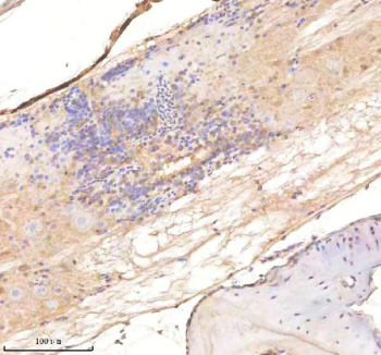 Zebrafish Twist Antibody Spinal Cord Tissue IHC. Immunohistochemistry staining of FFPE zebrafish spinal cord tissue with Twist antibody, HRP-labeled secondary and DAB substrate. HIER: boil tissue sections in pH8 EDTA for 20 min and allow to cool before testing.
