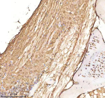 Zebrafish Cdc48 Antibody Spinal Cord Tissue IHC. Immunohistochemistry staining of FFPE zebrafish spinal cord tissue with Cdc48 antibody, HRP-labeled secondary and DAB substrate. HIER: boil tissue sections in pH8 EDTA for 20 min and allow to cool before testing.