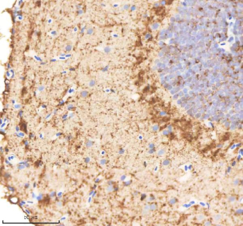 Zebrafish Cdc48 Antibody Brain Tissue IHC. Immunohistochemistry staining of FFPE zebrafish brain tissue with Cdc48 antibody, HRP-labeled secondary and DAB substrate. HIER: boil tissue sections in pH8 EDTA for 20 min and allow to cool before testing.