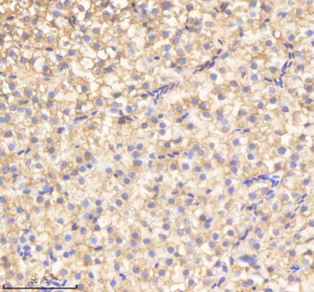 Zebrafish Cdc48 Antibody Liver Tissue IHC. Immunohistochemistry staining of FFPE zebrafish liver tissue with Cdc48 antibody, HRP-labeled secondary and DAB substrate. HIER: boil tissue sections in pH8 EDTA for 20 min and allow to cool before testing.