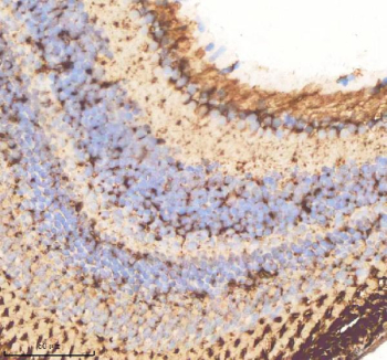 Zebrafish Cdc48 Antibody Eye Tissue IHC. Immunohistochemistry staining of FFPE zebrafish eye tissue with Cdc48 antibody, HRP-labeled secondary and DAB substrate. HIER: boil tissue sections in pH8 EDTA for 20 min and allow to cool before testing.