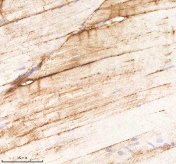 Zebrafish Cdc48 Antibody Muscle Tissue IHC. Immunohistochemistry staining of FFPE zebrafish muscle tissue with Cdc48 antibody, HRP-labeled secondary and DAB substrate. HIER: boil tissue sections in pH8 EDTA for 20 min and allow to cool before testing.
