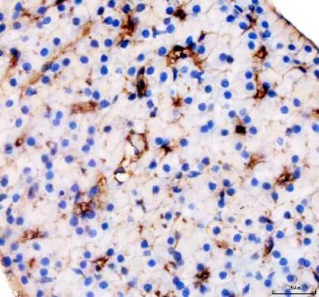 Zebrafish Vitamin D Binding Protein Antibody Liver IHC. Immunohistochemistry staining of FFPE zebrafish liver tissue using Zebrafish Vitamin D Binding Protein Antibody demonstrates distinct cytoplasmic HRP-DAB brown staining within scattered hepatic cell populations. The staining pattern is consistent with expression of Vitamin D Binding Protein (VDBP), also known as Group-Specific Component (GC), a multifunctional plasma glycoprotein involved in vitamin D metabolite transport, actin scavenging, and immune regulation. Positive staining is observed within liver-associated cellular compartments, consistent with the established role of hepatic tissue as a major site of VDBP synthesis and secretion. Heat mediated antigen retrieval was performed in EDTA buffer. Primary antibody was incubated overnight at 4Â°C followed by detection using a peroxidase-conjugated goat anti-rabbit secondary antibody and DAB chromogen.