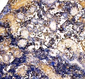 Zebrafish Vitamin D Binding Protein Antibody Kidney IHC. Immunohistochemistry staining of FFPE zebrafish kidney tissue using Zebrafish Vitamin D Binding Protein Antibody demonstrates moderate cytoplasmic HRP-DAB brown staining within renal tubular epithelial structures and associated cellular compartments. The staining pattern is consistent with expression of Vitamin D Binding Protein (VDBP), also known as Group-Specific Component (GC), a multifunctional plasma glycoprotein involved in vitamin D metabolite transport, actin scavenging, and regulation of immune-associated pathways. Signal is observed throughout renal tissue regions associated with filtration, transport, and metabolic homeostasis, reflecting the established relationship between vitamin D metabolism and kidney function. Heat mediated antigen retrieval was performed in EDTA buffer. Primary antibody was incubated overnight at 4Â°C followed by detection using a peroxidase-conjugated goat anti-rabbit secondary antibody and DAB chromogen.