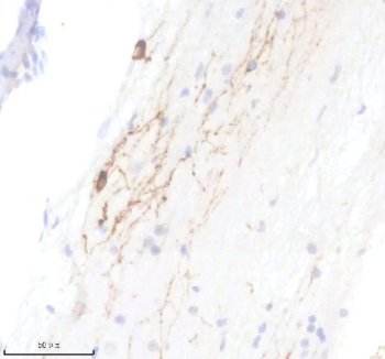 Zebrafish TPH2 Antibody Serotonergic Spinal Cord IHC. Immunohistochemistry staining of FFPE zebrafish spinal cord tissue using Zebrafish TPH2 Antibody demonstrates distinct cytoplasmic and neurite-associated HRP-DAB brown staining within scattered neural cell populations and elongated neuronal processes. The staining pattern is consistent with expression of Tryptophan Hydroxylase 2 (TPH2), the rate-limiting enzyme in serotonin biosynthesis and a well-established marker of serotonergic neurons. Signal is observed within neural structures associated with serotonergic neurotransmission, reflecting the role of TPH2 in regulating serotonin production and nervous system function. Heat mediated antigen retrieval was performed in EDTA buffer. Primary antibody was incubated overnight at 4Â°C followed by detection using a peroxidase-conjugated goat anti-rabbit secondary antibody and DAB chromogen.