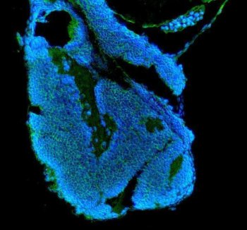 Zebrafish IGF1 Receptor / IGF1RA Antibody Embryo IF. Immunofluorescent staining of FFPE zebrafish embryo tissue using Zebrafish IGF1 Receptor Antibody demonstrates distinct green fluorescence within developing embryonic tissue compartments against a blue DAPI nuclear counterstain background. The staining pattern is consistent with expression of Insulin-Like Growth Factor 1 Receptor Alpha (IGF1RA), a receptor tyrosine kinase that mediates growth factor signaling involved in cellular proliferation, differentiation, survival, and developmental regulation. Signal is observed throughout embryonic structures undergoing active growth and morphogenesis, reflecting the established role of IGF signaling pathways in vertebrate development. Heat mediated antigen retrieval was performed in EDTA buffer. Primary antibody was incubated overnight at 4Â°C followed by detection using a DyLight 488-conjugated goat anti-rabbit secondary antibody. Nuclei were counterstained with DAPI.