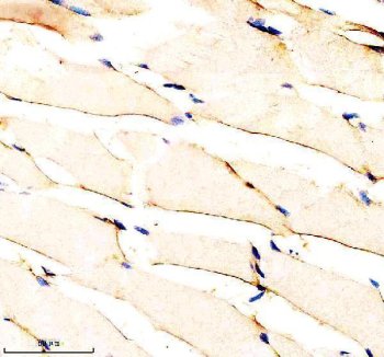 Zebrafish IGF1 Receptor / IGF1RA Antibody Muscle IHC. Immunohistochemistry staining of FFPE zebrafish muscle tissue using Zebrafish IGF1 Receptor Antibody demonstrates diffuse cytoplasmic HRP-DAB brown staining throughout elongated skeletal muscle fibers. The staining pattern is consistent with expression of Insulin-Like Growth Factor 1 Receptor Alpha (IGF1RA), a receptor tyrosine kinase that mediates growth factor signaling involved in cellular proliferation, differentiation, metabolism, and muscle development. Signal is observed within myofiber-associated cellular compartments, reflecting the established role of IGF signaling in skeletal muscle growth, maintenance, and tissue homeostasis. Heat mediated antigen retrieval was performed in EDTA buffer. Primary antibody was incubated overnight at 4Â°C followed by detection using a peroxidase-conjugated goat anti-rabbit secondary antibody and DAB chromogen.