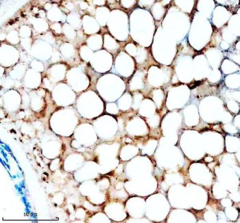 Zebrafish ACACA / Acetyl-CoA Carboxylase 1 Antibody Ovary IHC. Immunohistochemistry staining of FFPE zebrafish ovary tissue using Zebrafish ACACA Antibody demonstrates cytoplasmic HRP-DAB brown staining within ovarian follicular and oocyte-associated cellular compartments. The staining pattern is consistent with expression of Acetyl-CoA Carboxylase 1 (ACACA), also known as ACC1, a rate-limiting enzyme in fatty acid biosynthesis that catalyzes the formation of malonyl-CoA from acetyl-CoA. Prominent staining within lipid-rich ovarian tissue is consistent with the essential role of ACACA in lipid metabolism, membrane biogenesis, energy storage, and reproductive tissue development. Heat mediated antigen retrieval was performed in EDTA buffer. Primary antibody was incubated overnight at 4Â°C followed by detection using a peroxidase-conjugated goat anti-rabbit secondary antibody and DAB chromogen.