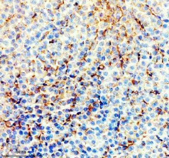 Zebrafish ACACA / Acetyl-CoA Carboxylase 1 Antibody Liver IHC. Immunohistochemistry staining of FFPE zebrafish liver tissue using Zebrafish ACACA Antibody demonstrates granular cytoplasmic HRP-DAB brown staining throughout hepatocyte-associated cellular populations. The staining pattern is consistent with expression of Acetyl-CoA Carboxylase 1 (ACACA), also known as ACC1, a rate-limiting enzyme in de novo fatty acid biosynthesis that catalyzes the conversion of acetyl-CoA to malonyl-CoA. Prominent hepatic staining is consistent with the central role of ACACA in lipid metabolism, energy storage, and regulation of fatty acid synthesis within the liver. Heat mediated antigen retrieval was performed in EDTA buffer. Primary antibody was incubated overnight at 4Â°C followed by detection using a peroxidase-conjugated goat anti-rabbit secondary antibody and DAB chromogen.