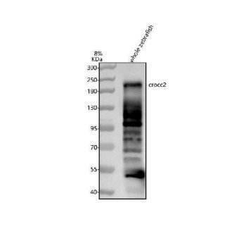 Zebrafish CROCC2 Antibody WB. Western blot analysis of whole zebrafish tissue lysate using Zebrafish CROCC2 Antibody demonstrates a prominent immunoreactive band at approximately 222 kDa, consistent with the predicted molecular weight of the CROCC2 gene product. Additional immunoreactive bands are observed at lower molecular weights, which may reflect alternative isoforms, proteolytic processing, post-translational modification, or non-specific antibody reactivity. Electrophoresis was performed on an 8% SDS-PAGE gel under reducing conditions followed by transfer to a nitrocellulose membrane. Signal was detected using an HRP-conjugated secondary antibody and enhanced chemiluminescent substrate.