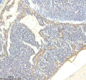 Zebrafish Titin Antibody IHC. Immunohistochemistry analysis of TTN using anti-TTN antibody. TTN was detected in a paraffin-embedded section of zebrafish heart tissue. Heat mediated antigen retrieval was performed in EDTA buffer. The tissue section was blocked with 10% goat serum. The tissue section was then incubated with 2 ug/ml rabbit anti-TTN Antibody overnight at 4oC. Peroxidase Conjugated Goat Anti-rabbit IgG was used as secondary antibody and incubated for 30 minutes at 37oC. The tissue section was developed using DAB as the chromogen.