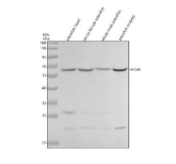 Zebrafish SLC5A5 Antibody WB. Western blot analysis of SLC5A5 using anti-SLC5A5 antibody. Electrophoresis was performed on a 10% SDS-PAGE gel for 2 hours. The sample well of each lane was loaded with 30 ug of sample under reducing conditions. Lane 1: zebrafish head tissue lysates, Lane 2: whole female zebrafish tissue lysates, Lane 3: whole male zebrafish tissue lysates, Lane 4: zebrafish embryo tissue lysates. After electrophoresis, proteins were transferred to a nitrocellulose membrane at 150 mA for 50-90 minutes. Blocked the membrane with 5% non-fat milk/TBS for 1.5 hour at RT. The membrane was incubated with rabbit anti-SLC5A5 antigen antibody at 0.5 ug/ml overnight at 4oC, then washed with TBS-0.1%Tween 3 times with 5 minutes each and probed with a goat anti-rabbit IgG-HRP secondary antibody at a dilution of 1:5000 for 1.5 hour at RT. The signal is developed using an ECL Plus WB. Western blotting Substrate with Tanon 5200 system. A specific band was detected for SLC5A5 at approximately 65 kDa. The expected band size for SLC5A5 is at 64 kDa.