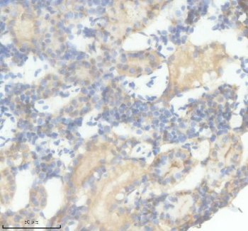 Zebrafish IFNPHI3 Antibody IHC. Immunohistochemistry analysis of IFNPHI3 using anti-IFNPHI3 antibody. IFNPHI3 was detected in a paraffin-embedded section of zebrafish kidney tissue. Heat mediated antigen retrieval was performed in EDTA buffer. The tissue section was blocked with 10% goat serum. The tissue section was then incubated with 2 ug/ml rabbit anti-IFNPHI3 Antibody overnight at 4oC. Peroxidase Conjugated Goat Anti-rabbit IgG was used as secondary antibody and incubated for 30 minutes at 37oC. The tissue section was developed using DAB as the chromogen.