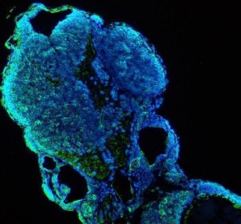 Zebrafish CYP1B1 Antibody IF. Immunofluorescence analysis of CYP1B1 using anti-CYP1B1 antibody. CYP1B1 was detected in a paraffin-embedded section of zebrafish embryo tissue. Heat mediated antigen retrieval was performed in EDTA buffer. The tissue section was blocked with 10% goat serum. The tissue section was then incubated with 5 ug/ml rabbit anti-CYP1B1 Antibody overnight at 4oC. DyLight-488 Conjugated Goat Anti-Rabbit IgG was used as secondary antibody at 1:500 dilution and incubated for 30 minutes at 37oC. The section was counterstained with DAPI. Visualize using a fluorescence microscope and filter sets appropriate for the label used.