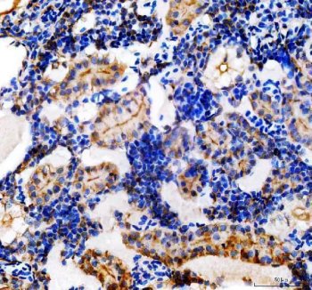 Zebrafish CYP1B1 Antibody IHC. Immunohistochemistry analysis of CYP1B1 using anti-CYP1B1 antibody. CYP1B1 was detected in a paraffin-embedded section of zebrafish kidney tissue. Heat mediated antigen retrieval was performed in EDTA buffer. The tissue section was blocked with 10% goat serum. The tissue section was then incubated with 2 ug/ml rabbit anti-CYP1B1 Antibody overnight at 4oC. Peroxidase Conjugated Goat Anti-rabbit IgG was used as secondary antibody and incubated for 30 minutes at 37oC. The tissue section was developed using DAB as the chromogen.