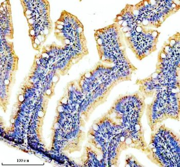 Zebrafish CYP1B1 Antibody IHC. Immunohistochemistry analysis of CYP1B1 using anti-CYP1B1 antibody. CYP1B1 was detected in a paraffin-embedded section of zebrafish colon tissue. Heat mediated antigen retrieval was performed in EDTA buffer. The tissue section was blocked with 10% goat serum. The tissue section was then incubated with 2 ug/ml rabbit anti-CYP1B1 Antibody overnight at 4oC. Peroxidase Conjugated Goat Anti-rabbit IgG was used as secondary antibody and incubated for 30 minutes at 37oC. The tissue section was developed using DAB as the chromogen.
