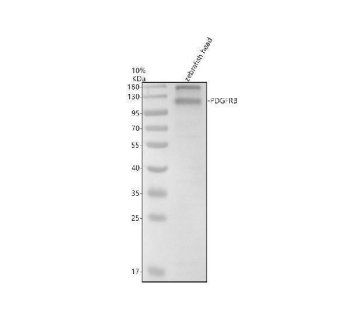 Zebrafish PDGFRB Antibody WB. Western blot analysis of PDGFRB using anti-PDGFRB antibody. Electrophoresis was performed on a 10% SDS-PAGE gel for 2 hours. The sample well of each lane was loaded with 30 ug of sample under reducing conditions. Lane 1: zebrafish head tissue lysates. After electrophoresis, proteins were transferred to a nitrocellulose membrane at 150 mA for 50-90 minutes. Blocked the membrane with 5% non-fat milk/TBS for 1.5 hour at RT. The membrane was incubated with rabbit anti-PDGFRB antigen antibody at 0.5 ug/ml overnight at 4oC, then washed with TBS-0.1%Tween 3 times with 5 minutes each and probed with a goat anti-rabbit IgG-HRP secondary antibody at a dilution of 1:5000 for 1.5 hour at RT. The signal is developed using an ECL Plus WB. Western blotting Substrate with Tanon 5200 system. A specific band was detected for PDGFRB at approximately 120 kDa. The expected band size for PDGFRB is at 120 kDa.
