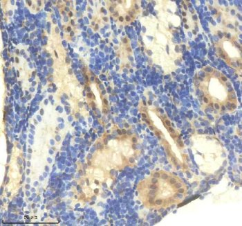 Zebrafish IkB Alpha / NFKBIAA Antibody Kidney IHC. Immunohistochemistry staining of FFPE zebrafish kidney tissue using Zebrafish IkB Alpha Antibody demonstrates cytoplasmic HRP-DAB brown staining within renal tubular epithelial cells and associated cellular populations. The staining pattern is consistent with expression of Nuclear Factor of Kappa Light Polypeptide Gene Enhancer in B-Cells Inhibitor Alpha A (NFKBIAA), also known as IkB Alpha, a key negative regulator of NF-kB signaling that controls inflammatory, immune, and stress-response pathways. Prominent staining within renal epithelial structures is consistent with the established role of NF-kB regulatory proteins in maintaining tissue homeostasis and coordinating cellular responses to physiological and environmental stimuli. Heat mediated antigen retrieval was performed in EDTA buffer. Primary antibody was incubated overnight at 4Â°C followed by detection using a peroxidase-conjugated goat anti-rabbit secondary antibody and DAB chromogen.