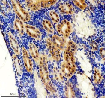 Zebrafish FOXJ1 / FOXJ1A Antibody Kidney IHC. Immunohistochemistry staining of FFPE zebrafish kidney tissue using Zebrafish FOXJ1 Antibody demonstrates prominent nuclear and cytoplasmic HRP-DAB brown staining within renal tubular epithelial cell populations. The staining pattern is consistent with expression of Forkhead Box J1A (FOXJ1A), a transcription factor that serves as a master regulator of motile ciliogenesis and ciliated cell differentiation. Strong epithelial-associated staining is consistent with the established role of FOXJ1A in regulating genes required for cilia formation, ciliary motility, and maintenance of specialized epithelial cell functions. Heat mediated antigen retrieval was performed in EDTA buffer. Primary antibody was incubated overnight at 4Â°C followed by detection using a peroxidase-conjugated goat anti-rabbit secondary antibody and DAB chromogen.