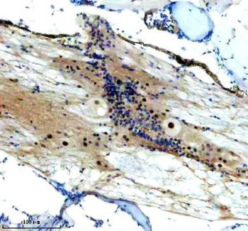 Zebrafish FOXJ1 / FOXJ1A Antibody Spinal Cord IHC. Immunohistochemistry staining of FFPE zebrafish spinal cord tissue using Zebrafish FOXJ1 Antibody demonstrates nuclear and cytoplasmic HRP-DAB brown staining within cells associated with spinal cord and surrounding neural tissue compartments. The staining pattern is consistent with expression of Forkhead Box J1A (FOXJ1A), a transcription factor that regulates motile ciliogenesis and controls gene expression programs required for ciliated cell differentiation. Signal is observed within neural-associated cellular populations, reflecting the established role of FOXJ1A in cilia-dependent developmental processes, tissue organization, and maintenance of specialized cell populations within the vertebrate nervous system. Heat mediated antigen retrieval was performed in EDTA buffer. Primary antibody was incubated overnight at 4Â°C followed by detection using a peroxidase-conjugated goat anti-rabbit secondary antibody and DAB chromogen.