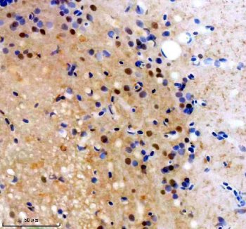 Zebrafish FOXJ1 / FOXJ1A Antibody Brain IHC. Immunohistochemistry staining of FFPE zebrafish brain tissue using Zebrafish FOXJ1 Antibody demonstrates nuclear-predominant HRP-DAB brown staining within scattered neural-associated cellular populations. The staining pattern is consistent with expression of Forkhead Box J1A (FOXJ1A), a transcription factor that serves as a master regulator of motile ciliogenesis and ciliated cell differentiation. Signal is observed within brain-associated tissue compartments, reflecting the established role of FOXJ1A in regulating cilia-related gene expression, neural development, and maintenance of specialized cell populations within the vertebrate nervous system. Heat mediated antigen retrieval was performed in EDTA buffer. Primary antibody was incubated overnight at 4Â°C followed by detection using a peroxidase-conjugated goat anti-rabbit secondary antibody and DAB chromogen.