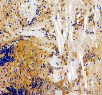 Zebrafish HSD17B1 / 17B-HSD1 Antibody Brain IHC. Immunohistochemistry staining of FFPE zebrafish brain tissue using Zebrafish HSD17B1 Antibody demonstrates cytoplasmic HRP-DAB brown staining within scattered neural-associated cellular populations throughout brain tissue. The staining pattern is consistent with expression of Hydroxysteroid 17-Beta Dehydrogenase 1 (HSD17B1), also known as 17B-HSD1, an enzyme that catalyzes key reactions in estrogen biosynthesis and steroid hormone metabolism. Signal is observed within brain-associated tissue compartments, reflecting the established role of steroidogenic enzymes in neuroendocrine regulation, hormone-responsive signaling pathways, and maintenance of vertebrate nervous system function. Heat mediated antigen retrieval was performed in EDTA buffer. Primary antibody was incubated overnight at 4Â°C followed by detection using a peroxidase-conjugated goat anti-rabbit secondary antibody and DAB chromogen.