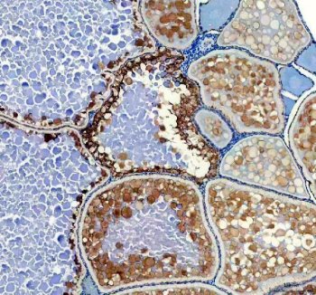 Zebrafish HSD17B1 / 17B-HSD1 Antibody Ovary IHC. Immunohistochemistry staining of FFPE zebrafish ovary tissue using Zebrafish HSD17B1 Antibody demonstrates strong cytoplasmic HRP-DAB brown staining within ovarian follicular and oocyte-associated cellular populations. The staining pattern is consistent with expression of Hydroxysteroid 17-Beta Dehydrogenase 1 (HSD17B1), also known as 17B-HSD1, a key steroidogenic enzyme that catalyzes the conversion of estrone to biologically active estradiol. Prominent staining within ovarian tissue is consistent with the established role of HSD17B1 in estrogen biosynthesis, reproductive physiology, gonadal development, and endocrine regulation. Heat mediated antigen retrieval was performed in EDTA buffer. Primary antibody was incubated overnight at 4Â°C followed by detection using a peroxidase-conjugated goat anti-rabbit secondary antibody and DAB chromogen.