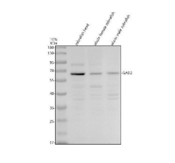Zebrafish GAD65 / GAD2 Antibody Neurotransmitter Synthesis WB. Western blot analysis of zebrafish head tissue, whole female zebrafish, and whole male zebrafish lysates using Zebrafish GAD65 Antibody demonstrates a prominent immunoreactive band at approximately 65 kDa, consistent with the predicted molecular weight of Glutamate Decarboxylase 2 (GAD2), also known as GAD65. GAD65 is a key enzyme responsible for the synthesis of gamma-aminobutyric acid (GABA), the principal inhibitory neurotransmitter in the vertebrate nervous system. The observed band is detected across multiple zebrafish tissue preparations, consistent with the widespread importance of GABAergic signaling in neural function and neurotransmitter regulation. Minor lower-intensity bands are also present and may represent antibody-reactive species, alternatively processed forms, or non-specific background reactivity. Electrophoresis was performed on a 10% SDS-PAGE gel under reducing conditions followed by transfer to a nitrocellulose membrane. Signal was detected using an HRP-conjugated secondary antibody and enhanced chemiluminescent substrate.