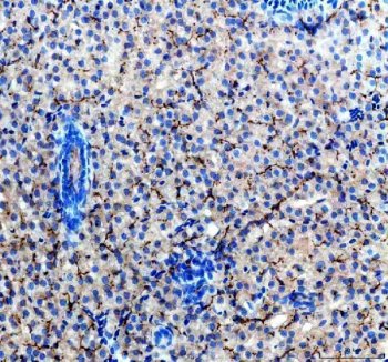 Zebrafish ACVR1L / ALK8 Antibody Liver IHC. Immunohistochemistry staining of FFPE zebrafish liver tissue using Zebrafish ACVR1L Antibody demonstrates widespread cytoplasmic HRP-DAB brown staining throughout hepatocyte populations. The staining pattern is consistent with expression of Activin Receptor Type 1-Like (ACVR1L), also known as ALK8, a transmembrane serine/threonine kinase receptor that mediates BMP and TGF-beta signaling pathways. Hepatic expression of ACVR1L is consistent with the broad involvement of BMP receptor signaling in cellular differentiation, tissue homeostasis, developmental regulation, and growth factor-mediated signaling processes. Heat mediated antigen retrieval was performed in EDTA buffer. Primary antibody was incubated overnight at 4Â°C followed by detection using a peroxidase-conjugated goat anti-rabbit secondary antibody and DAB chromogen.