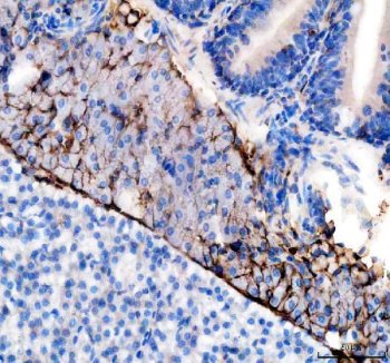 Zebrafish Vitellogenin 2 / VTG2 Antibody Pancreas IHC. Immunohistochemistry staining of FFPE zebrafish pancreas tissue using Zebrafish Vitellogenin 2 Antibody demonstrates distinct membranous and cytoplasmic HRP-DAB brown staining within clustered pancreatic epithelial cell populations. The staining pattern is consistent with expression of Vitellogenin 2 (VTG2), a large lipid-binding yolk precursor protein involved in nutrient transport, reproductive physiology, and estrogen-responsive signaling pathways. The observed immunoreactivity highlights discrete cellular populations within the pancreatic tissue and is consistent with the broad physiological functions of vitellogenin family proteins in vertebrate metabolism, nutrient mobilization, and developmental biology. Heat mediated antigen retrieval was performed in EDTA buffer. Primary antibody was incubated overnight at 4Â°C followed by detection using a peroxidase-conjugated goat anti-rabbit secondary antibody and DAB chromogen.
