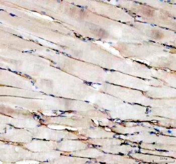 Zebrafish Vitellogenin 2 / VTG2 Antibody Skeletal Muscle IHC. Immunohistochemistry staining of FFPE zebrafish skeletal muscle tissue using Zebrafish Vitellogenin 2 Antibody demonstrates weak to moderate HRP-DAB brown staining associated with elongated muscle fibers and interstitial cellular elements. The staining pattern is consistent with expression of Vitellogenin 2 (VTG2), a lipid-binding yolk precursor protein involved in nutrient transport, reproductive physiology, and estrogen-responsive biological processes. Although vitellogenins are classically associated with hepatic synthesis and oocyte development, detection in additional tissue compartments may reflect broader physiological roles in nutrient mobilization and metabolic regulation. Heat mediated antigen retrieval was performed in EDTA buffer. Primary antibody was incubated overnight at 4Â°C followed by detection using a peroxidase-conjugated goat anti-rabbit secondary antibody and DAB chromogen.