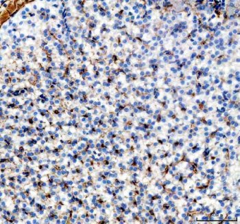 Zebrafish Vitellogenin 2 / VTG2 Antibody Liver IHC. Immunohistochemistry staining of FFPE zebrafish liver tissue using Zebrafish Vitellogenin 2 Antibody demonstrates widespread granular cytoplasmic HRP-DAB brown staining throughout hepatocyte populations. The staining pattern is consistent with expression of Vitellogenin 2 (VTG2), a major yolk precursor protein synthesized primarily in the liver under estrogen-responsive regulation and subsequently transported to developing oocytes. Hepatic localization is consistent with the established biological role of vitellogenins in nutrient transport, reproductive physiology, embryonic nutrition, and endocrine-regulated metabolic processes. The widespread hepatocellular staining observed in this section supports the liver as a principal site of VTG2 production in zebrafish. Heat mediated antigen retrieval was performed in EDTA buffer. Primary antibody was incubated overnight at 4Â°C followed by detection using a peroxidase-conjugated goat anti-rabbit secondary antibody and DAB chromogen.