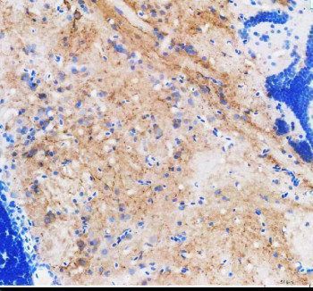 Zebrafish SLC6A4 / SLC6A4A Antibody Serotonergic Brain IHC. Immunohistochemistry staining of FFPE zebrafish brain tissue using Zebrafish SLC6A4 Antibody demonstrates widespread cytoplasmic and neurite-associated HRP-DAB brown staining throughout neural tissue compartments. Signal is observed within neuronal cell populations and surrounding neuropil-rich regions, consistent with expression of Solute Carrier Family 6 Member 4A (SLC6A4A), a serotonin transporter involved in the regulation of serotonergic neurotransmission through reuptake of extracellular serotonin. The staining pattern highlights neural structures associated with serotonin-dependent signaling pathways and neuronal communication. Heat mediated antigen retrieval was performed in EDTA buffer. Primary antibody was incubated overnight at 4Â°C followed by detection using a peroxidase-conjugated goat anti-rabbit secondary antibody and DAB chromogen.