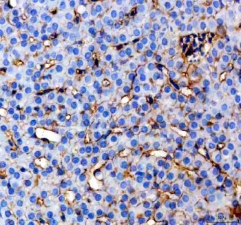 Zebrafish CYP3A65 Antibody Liver IHC. Immunohistochemistry staining of paraffin-embedded zebrafish liver tissue using Zebrafish CYP3A65 Antibody / Cytochrome P450 Enzyme Antibody demonstrates predominantly cytoplasmic HRP-DAB brown staining throughout hepatocyte populations. The staining pattern is consistent with expression of Cytochrome P450 3A65 (CYP3A65), a member of the cytochrome P450 enzyme family involved in xenobiotic metabolism, detoxification, and oxidative biotransformation of endogenous and exogenous compounds. Hepatic localization is consistent with the established role of CYP3A family enzymes in drug metabolism and chemical processing within the liver. The observed staining highlights metabolically active hepatocytes and supports the use of CYP3A65 as a marker for studies of toxicology, pharmacology, metabolic regulation, and environmental response pathways in zebrafish. Heat-mediated antigen retrieval was performed in pH 8.0 EDTA buffer prior to staining.