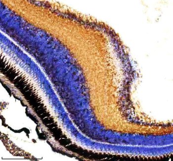 Zebrafish CYP3A65 Antibody Eye IHC. Immunohistochemistry staining of paraffin-embedded zebrafish eye tissue using Zebrafish CYP3A65 Antibody / Cytochrome P450 Enzyme Antibody demonstrates strong cytoplasmic HRP-DAB brown staining within retinal cell layers, with prominent immunoreactivity extending across multiple neural and photoreceptor-associated regions of the retina. The staining pattern is consistent with expression of Cytochrome P450 3A65 (CYP3A65), a member of the cytochrome P450 enzyme family involved in xenobiotic metabolism, detoxification, and oxidative processing of endogenous signaling molecules. Retinal expression is consistent with a role for CYP3A65 in local metabolic regulation and protection of ocular tissues from endogenous and environmental compounds. The observed staining highlights the metabolically active nature of retinal cells and supports the use of CYP3A65 as a target for studies of ocular biology, toxicology, and cytochrome P450-mediated metabolic pathways in zebrafish. Heat-mediated antigen retrieval was performed in EDTA buffer prior to staining.