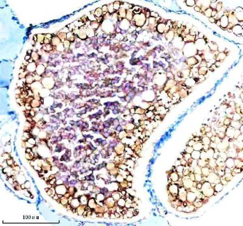 Zebrafish CYP3A65 Antibody Ovary IHC. Immunohistochemistry staining of paraffin-embedded zebrafish ovary tissue using Zebrafish CYP3A65 Antibody / Cytochrome P450 Enzyme Antibody demonstrates strong cytoplasmic and membranous HRP-DAB brown staining within ovarian follicular cells surrounding developing oocytes. The staining pattern is consistent with expression of Cytochrome P450 3A65 (CYP3A65), a member of the cytochrome P450 enzyme family involved in xenobiotic metabolism and oxidative processing of endogenous compounds. Ovarian localization is consistent with the role of cytochrome P450 enzymes in steroid metabolism, reproductive physiology, and regulation of hormone-associated signaling pathways. The prominent staining observed in follicle-associated cell populations highlights metabolically active compartments involved in oocyte development and reproductive function. These findings support the use of CYP3A65 as a target for studies of zebrafish reproductive biology, endocrine regulation, toxicology, and cytochrome P450-mediated metabolic pathways. Heat-mediated antigen retrieval was performed in EDTA buffer prior to staining.