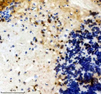 Zebrafish FGF20 Antibody Brain IHC. Immunohistochemistry staining of paraffin-embedded zebrafish brain tissue using Zebrafish FGF20 Antibody / FGF20A Antibody demonstrates cytoplasmic HRP-DAB brown staining within scattered neural cell populations and adjacent neuropil-rich regions. The staining pattern is consistent with expression of Fibroblast Growth Factor 20A (FGF20A), a secreted growth factor involved in developmental signaling, neural differentiation, cellular survival, and tissue regeneration. Expression within brain tissue is consistent with the established role of fibroblast growth factor family members in nervous system development and maintenance. The observed immunoreactivity supports the use of FGF20A as a marker for studies investigating neurodevelopment, regenerative signaling pathways, and growth factor-mediated cellular communication in zebrafish. Heat-mediated antigen retrieval was performed in EDTA buffer prior to staining.