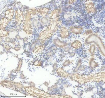 Zebrafish FGF20 Antibody Kidney IHC. Immunohistochemistry staining of paraffin-embedded zebrafish kidney tissue using Zebrafish FGF20 Antibody / FGF20A Antibody demonstrates moderate cytoplasmic and membranous HRP-DAB brown staining within epithelial cells lining renal tubules and associated nephric structures. The staining pattern is consistent with expression of Fibroblast Growth Factor 20A (FGF20A), a secreted signaling molecule involved in regulation of cellular proliferation, differentiation, survival, and tissue maintenance. Renal localization is consistent with the broad role of fibroblast growth factor family members in organ development, tissue homeostasis, and regenerative signaling pathways. The observed immunoreactivity highlights epithelial compartments actively engaged in growth factor-mediated cellular communication and supports the use of FGF20A as a target for studies of zebrafish development, regeneration, and growth factor signaling. Heat-mediated antigen retrieval was performed in EDTA buffer prior to staining.