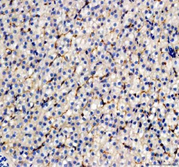 Zebrafish EpCAM Antibody Liver IHC. Immunohistochemistry staining of paraffin-embedded zebrafish liver tissue using Zebrafish EpCAM Antibody / CD326 Antibody demonstrates membranous and cytoplasmic HRP-DAB brown staining within hepatocyte populations and associated epithelial cell compartments. The staining pattern is consistent with expression of Epithelial Cell Adhesion Molecule (EPCAM/CD326), a transmembrane glycoprotein involved in epithelial cell adhesion, tissue organization, and regulation of cellular signaling pathways. Hepatic expression of EpCAM is consistent with its role in maintaining epithelial architecture and supporting cellular communication within organized tissue structures. The observed staining supports the use of EPCAM as a marker for studies investigating epithelial biology, tissue development, regenerative responses, and cell adhesion mechanisms in zebrafish. Heat-mediated antigen retrieval was performed in EDTA buffer prior to staining.
