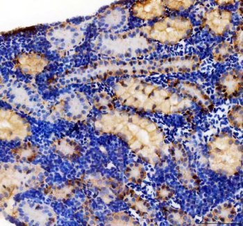 Zebrafish EpCAM Antibody Kidney IHC. Immunohistochemistry staining of paraffin-embedded zebrafish kidney tissue using Zebrafish EpCAM Antibody / CD326 Antibody demonstrates prominent membranous and cytoplasmic HRP-DAB brown staining within epithelial cells lining renal tubules and nephric structures. The staining pattern is consistent with expression of Epithelial Cell Adhesion Molecule (EPCAM/CD326), a transmembrane glycoprotein involved in epithelial cell adhesion, tissue organization, and maintenance of epithelial integrity. Renal epithelial localization is consistent with the established role of EpCAM in supporting cell-cell interactions and preserving the structural architecture of epithelial tissues. The observed staining highlights tubular epithelial compartments and supports the use of EPCAM as a marker for studies of epithelial biology, organ development, tissue homeostasis, and regenerative processes in zebrafish. Heat-mediated antigen retrieval was performed in EDTA buffer prior to staining.