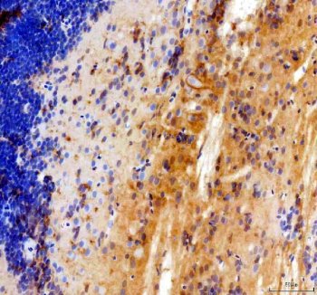 Zebrafish Myostatin Antibody Colon IHC. Immunohistochemistry analysis of MSTNA using Zebrafish Myostatin Antibody / MSTNA Antibody demonstrates distinct cytoplasmic HRP-DAB brown staining within smooth muscle and stromal-associated cellular populations of zebrafish colon tissue. The staining pattern is consistent with expression of Myostatin A (MSTNA), a member of the TGF-beta superfamily that functions as a negative regulator of muscle growth and tissue remodeling. Prominent immunoreactivity within muscle-associated compartments supports the established role of MSTNA in regulating muscle development, cellular differentiation, and growth control pathways. The observed staining demonstrates the utility of this antibody for studies of gastrointestinal muscle biology, myogenesis, developmental signaling, and tissue homeostasis in zebrafish models. Heat-mediated antigen retrieval was performed in EDTA buffer prior to staining.