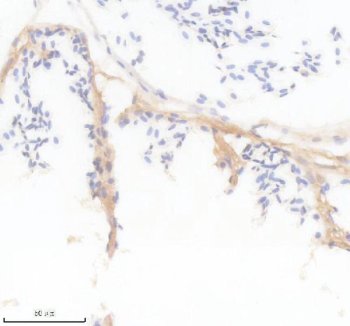 Zebrafish Myostatin Antibody WB. Western blot analysis of MSTNA using Zebrafish Myostatin Antibody / MSTNA Antibody demonstrates a distinct immunoreactive band at approximately 41 kDa in zebrafish head, whole female, whole male, and embryo tissue lysates. The observed molecular weight is consistent with the predicted size of Myostatin A (MSTNA), a member of the TGF-beta superfamily that functions as a key negative regulator of skeletal muscle growth and development. Detection of the expected target across multiple developmental and adult tissue samples supports broad expression of MSTNA and confirms specific recognition of the protein. The observed immunoreactivity demonstrates the utility of this antibody for studies of myogenesis, muscle growth regulation, developmental signaling, regenerative biology, and TGF-beta pathway function in zebrafish models.