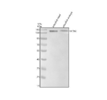 Zebrafish Collagen I Antibody WB. Western blot analysis of Collagen Type I Alpha 2 Chain (COL1A2) using Zebrafish Collagen I Antibody / COL1A2 Antibody demonstrates a prominent immunoreactive band at approximately 150 kDa in zebrafish head and embryo tissue lysates. The detected protein migrates above the predicted molecular weight of approximately 127 kDa, a finding that is consistent with the large size, extensive post-translational modification, and extracellular matrix-associated nature of type I collagen proteins. Strong detection in both developmental and adult-associated tissue samples supports expression of COL1A2 during connective tissue formation and extracellular matrix maintenance. The observed immunoreactivity demonstrates the utility of this antibody for studies of collagen biology, connective tissue development, extracellular matrix organization, skeletal formation, tissue remodeling, and regenerative processes in zebrafish models.