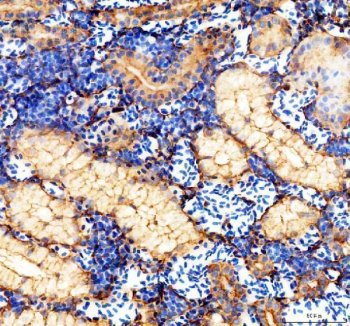 Zebrafish Cytokeratin 8 Antibody Kidney IHC. Immunohistochemistry analysis of KRT8 using Zebrafish Cytokeratin 8 Antibody / KRT8 Antibody demonstrates prominent cytoplasmic and membranous HRP-DAB brown staining within epithelial cells lining renal tubular and glandular-like structures of zebrafish kidney tissue. The staining pattern is consistent with expression of Keratin 8 (KRT8), a type II intermediate filament protein that contributes to epithelial cell architecture, cytoskeletal stability, and tissue organization. Strong immunoreactivity within epithelial compartments supports the established role of KRT8 in maintaining epithelial integrity and cellular homeostasis. The observed staining demonstrates the utility of this antibody for studies of kidney development, epithelial biology, intermediate filament organization, tissue differentiation, and cytoskeletal regulation in zebrafish models. Heat-mediated antigen retrieval was performed in EDTA buffer prior to staining.