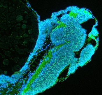 Zebrafish TUBA1A Antibody Embryo IF. Immunofluorescent staining of paraffin-embedded zebrafish embryo tissue using Zebrafish TUBA1A Antibody / Alpha Tubulin Antibody demonstrates strong green fluorescence throughout developing neural and embryonic tissue structures, consistent with the widespread distribution of alpha tubulin-containing microtubule networks during embryogenesis. TUBA1A is a highly conserved cytoskeletal protein required for microtubule assembly, neuronal differentiation, intracellular transport, and tissue morphogenesis. The staining pattern highlights regions of active cellular organization and developmental growth, while DAPI (blue) counterstains cell nuclei. Heat-mediated antigen retrieval was performed in EDTA buffer. Sections were blocked with 10% goat serum and incubated overnight at 4Â°C with 5 Âµg/ml primary antibody, followed by DyLight 488-conjugated goat anti-rabbit IgG secondary antibody at 1:500 dilution for 30 minutes at 37Â°C.