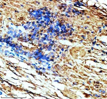 Zebrafish TUBA1A Antibody Spinal Cord IHC. Immunohistochemical staining of paraffin-embedded zebrafish spinal cord tissue using Zebrafish TUBA1A Antibody / Alpha Tubulin Antibody demonstrates distinct cytoplasmic HRP-DAB brown staining within spinal cord cellular populations and surrounding neural structures. The staining pattern is consistent with expression of Alpha Tubulin (TUBA1A), a highly conserved microtubule-associated protein required for cytoskeletal organization, neuronal differentiation, axonal growth, and intracellular transport. TUBA1A immunoreactivity highlights neural tissue architecture and cellular organization within the developing zebrafish spinal cord. Heat-mediated antigen retrieval was performed in EDTA buffer. Sections were blocked with 10% goat serum and incubated overnight at 4Â°C with 2 Âµg/ml primary antibody, followed by peroxidase-conjugated goat anti-rabbit IgG secondary antibody for 30 minutes at 37Â°C. Signal was visualized using DAB chromogen.